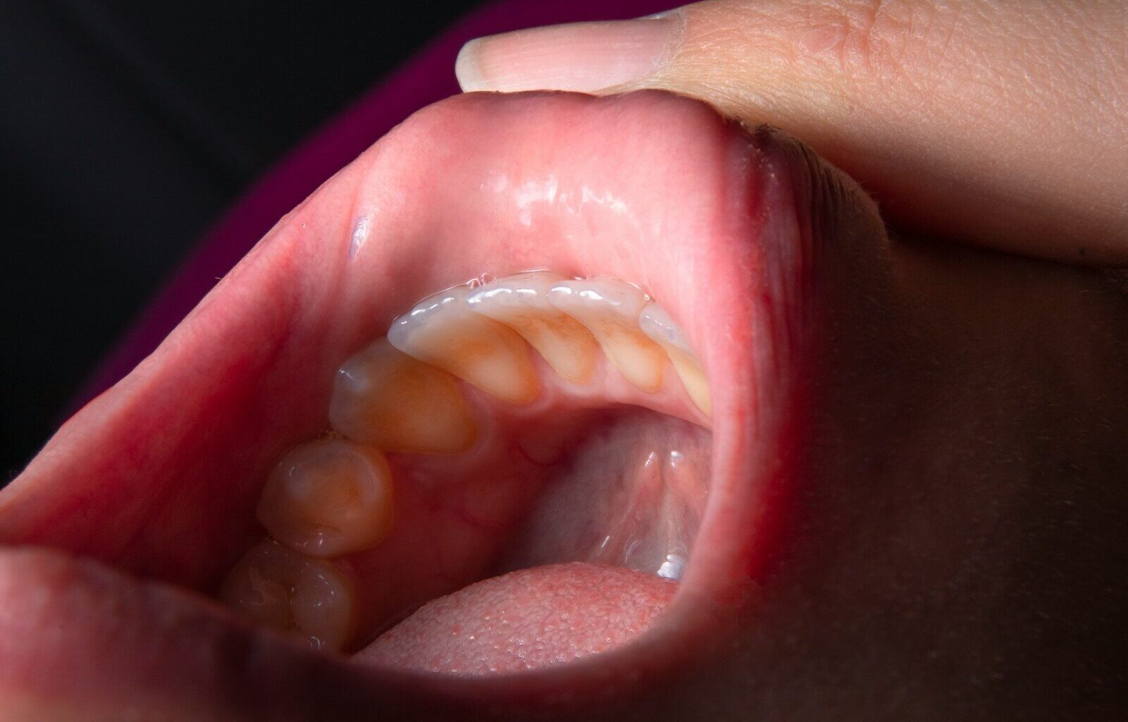 a person holding a baby's mouth