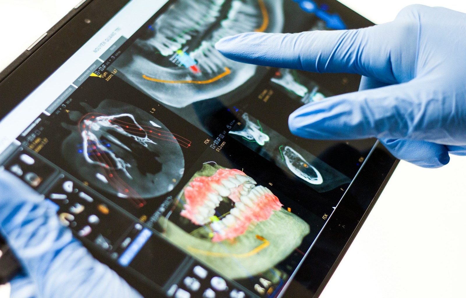 tecnologia odontológica CBCT DSD