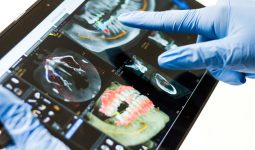 tecnologia odontológica CBCT DSD