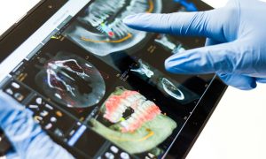tecnologia odontológica CBCT DSD