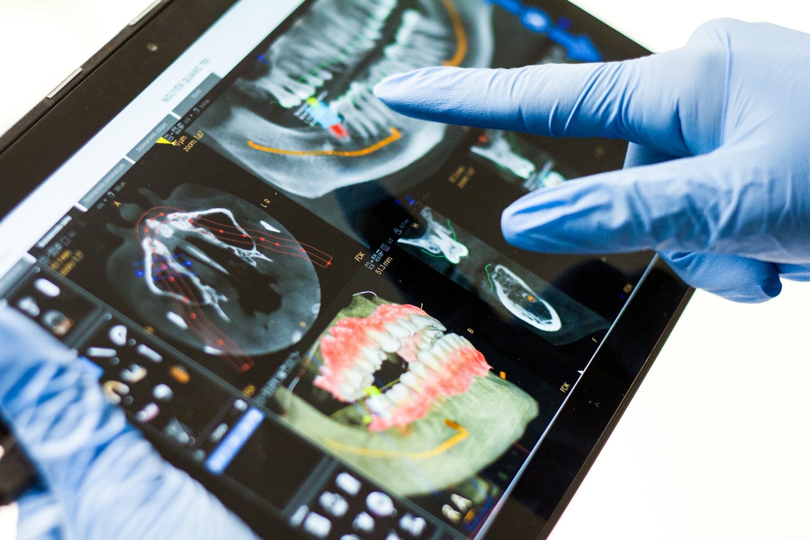 tecnologia odontológica CBCT DSD