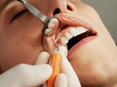 gum graft surgery