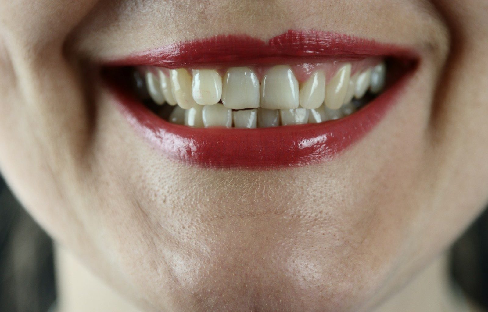 smoking effects on teeth gums