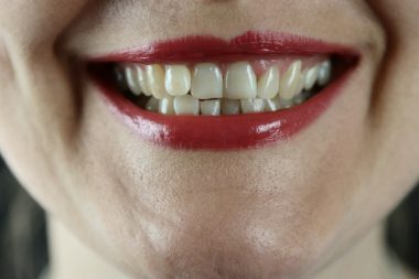 smoking effects on teeth gums