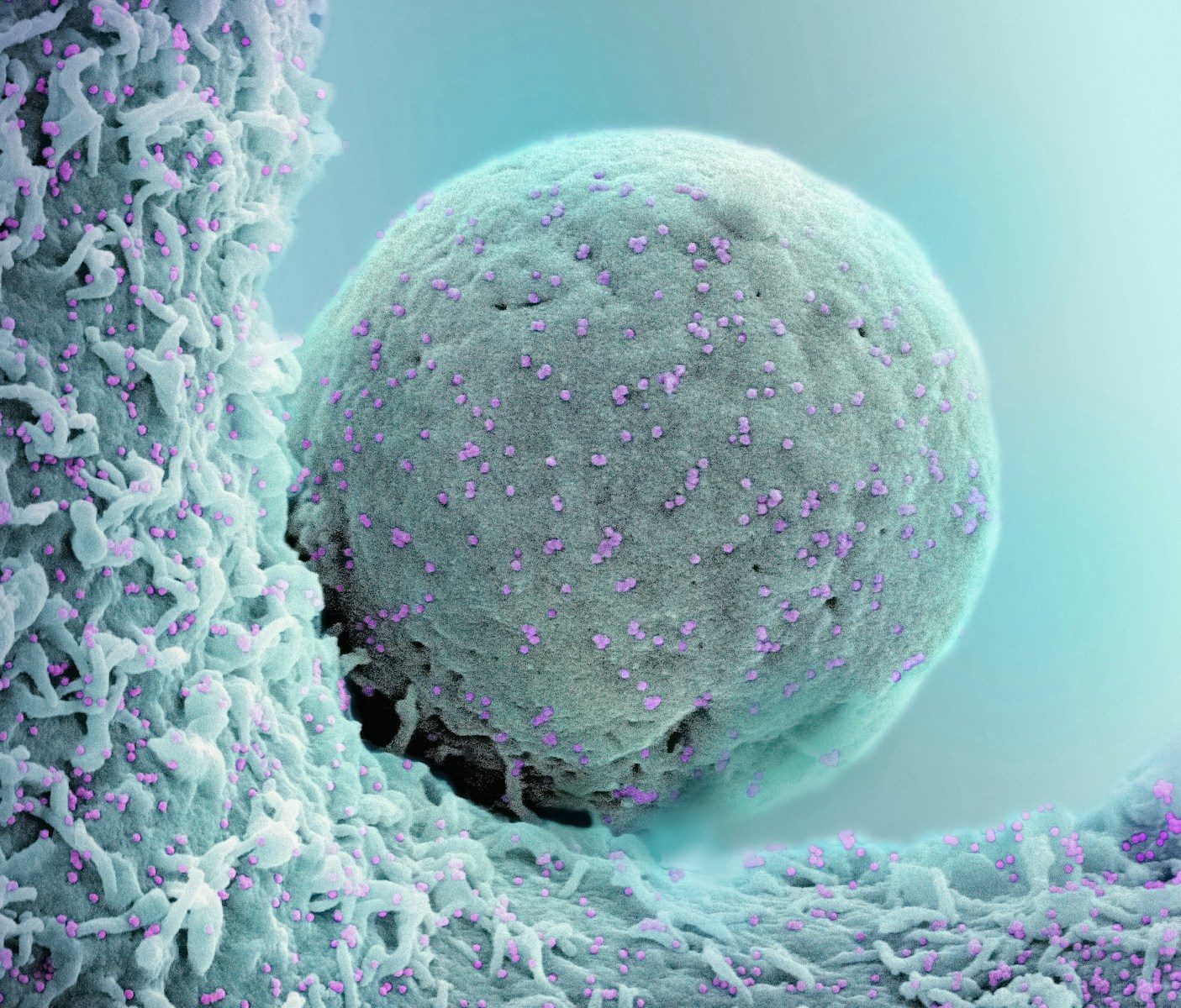 oral cancer early signs