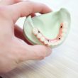 zygomatic dental implant