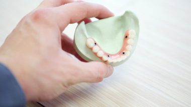 zygomatic dental implant