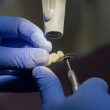 dental crown on implant