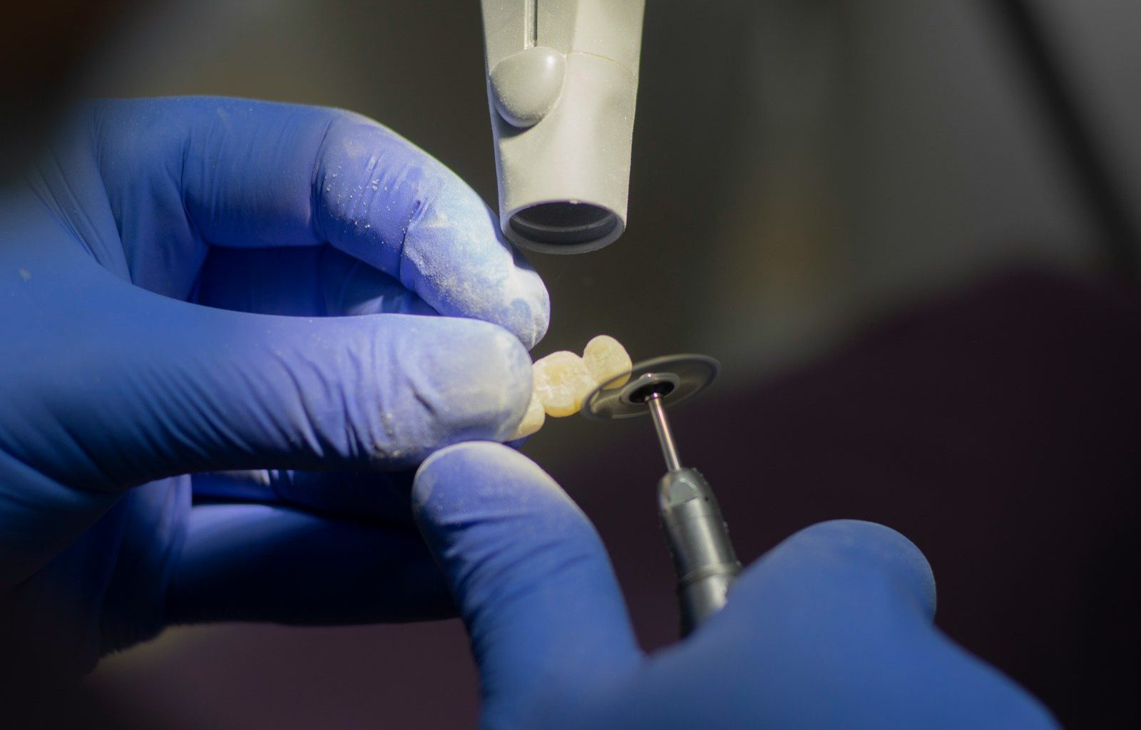 dental crown on implant