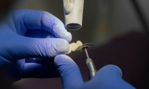 dental crown on implant
