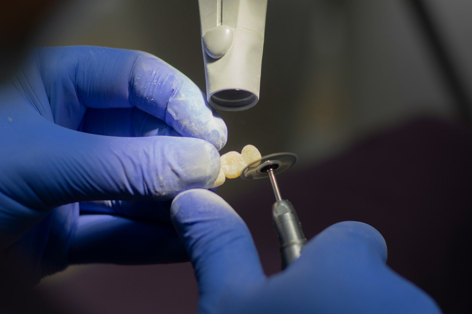 dental crown on implant