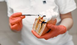 Close-up of dentist holding a tooth model, illustrating dental care concepts.