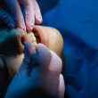 A dentist examines a patient's teeth during a dental procedure under bright clinic lights.