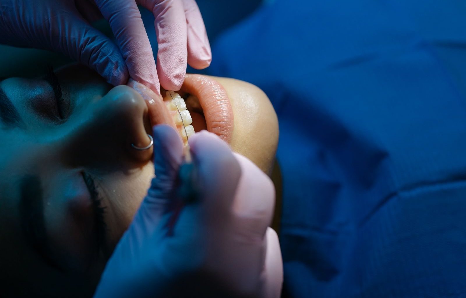 A dentist examines a patient's teeth during a dental procedure under bright clinic lights.